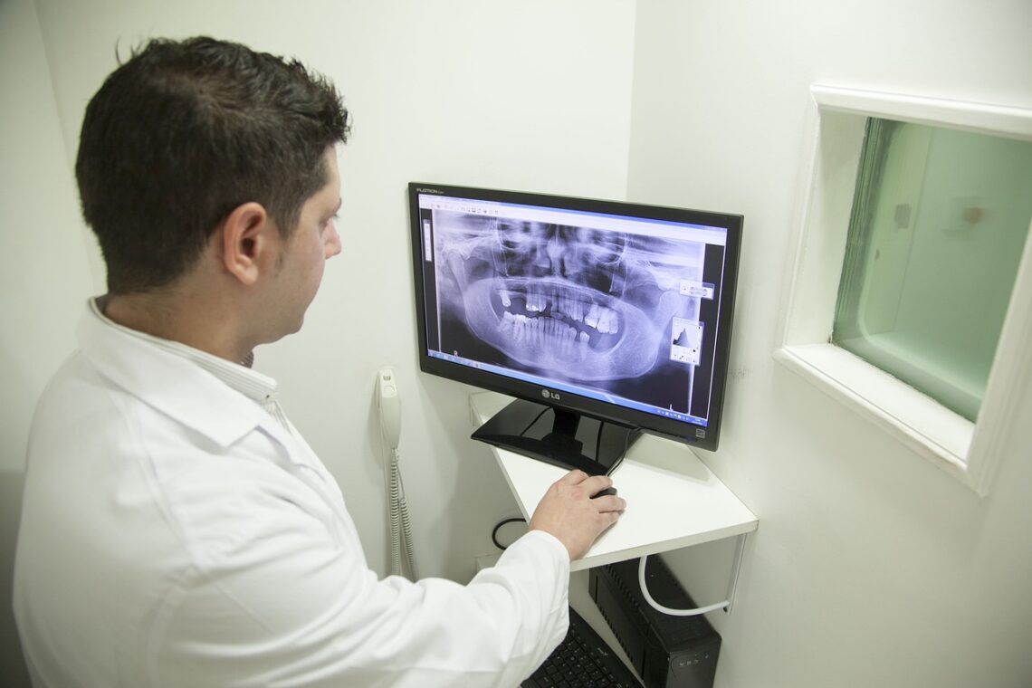 Image of Doctor looking at jaw X-Ray