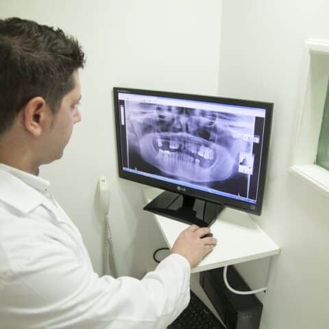 Image of Doctor looking at jaw X-Ray